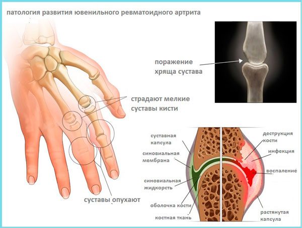 Ревматолог в Запоріжжі
