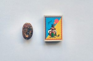 Камни в желчном пузыре