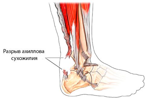 Клиника ортопедии, артрологии и спортивной травмы в Запорожье