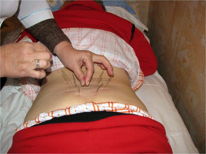 Реабилитация в Запорожье фото 4