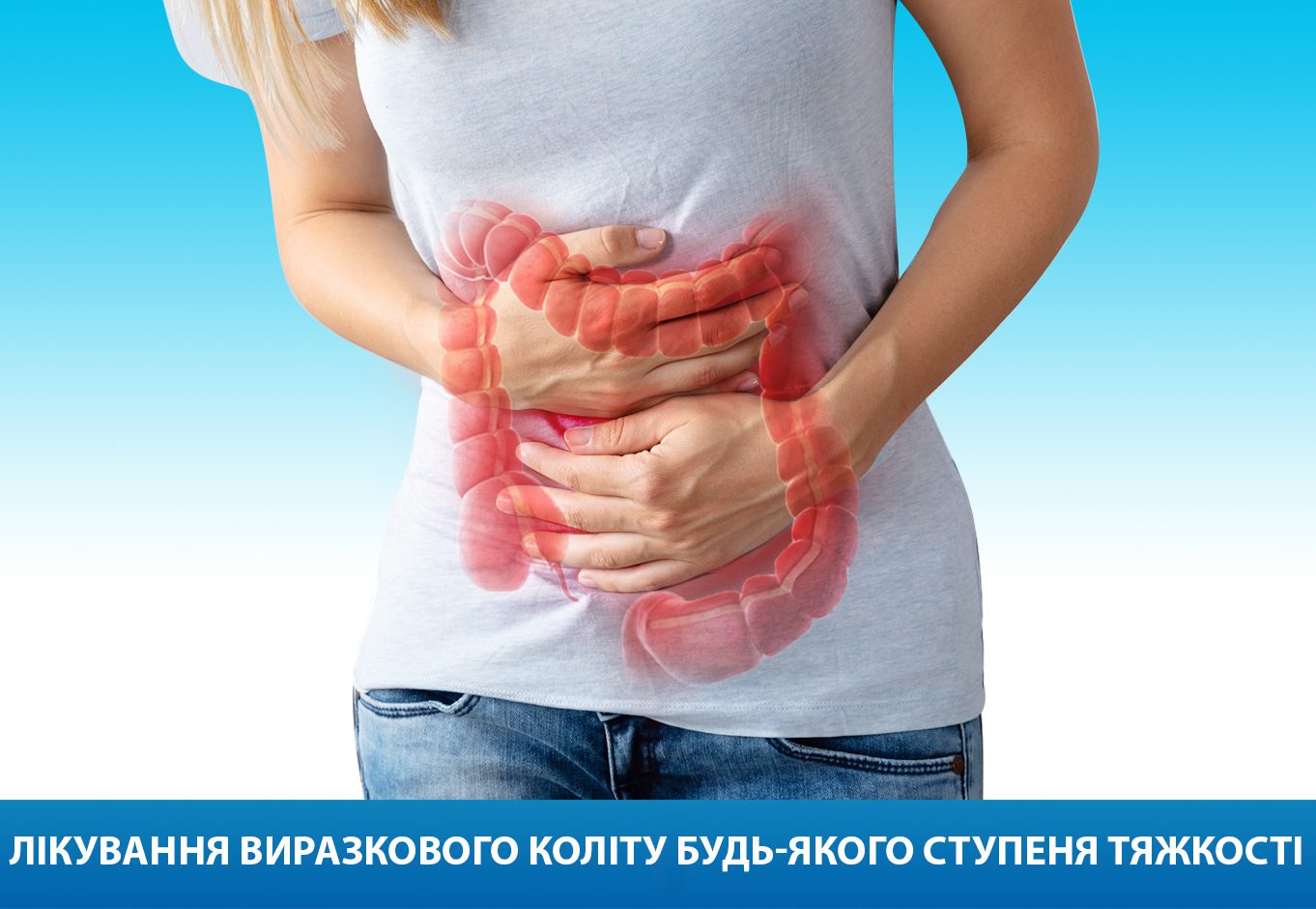 Неспецифічний виразковий коліт