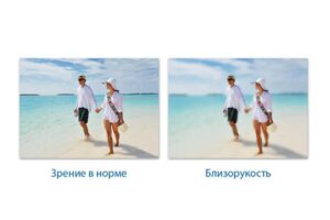 Лазерная коррекция зрения при миопии в Запорожье