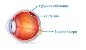 Лікування відшарування сітківки ока у Запоріжжі