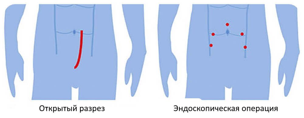 Эндоскопические операции в урологии в Запорожье Эндоскопические операции в урологии в Запорожье
