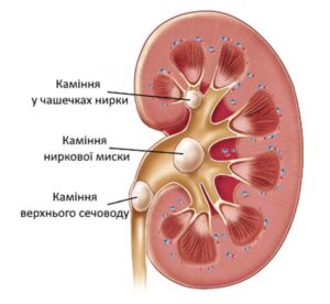 Контактне дроблення каміння у Запоріжжі