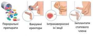 Лікування еректильної дисфункції у Запоріжжі