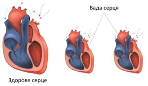 Лікування вроджених вад серця в обласній лікарні Запоріжжя