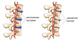Лечение болезни Бехтерева в областной больнице Запорожья 1