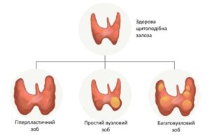 Lechenie zoba v oblastnoj bolnitse Zaporozhya ukr