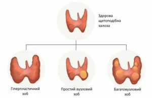 Lechenie zoba v oblastnoj bolnitse Zaporozhya ukr