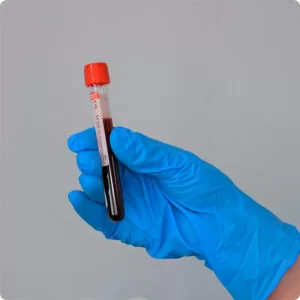 ferritin анализ