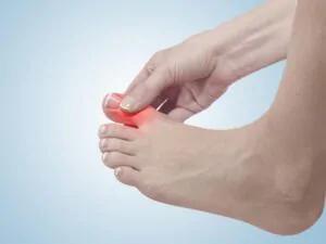 боль в пальцах ног при подагре