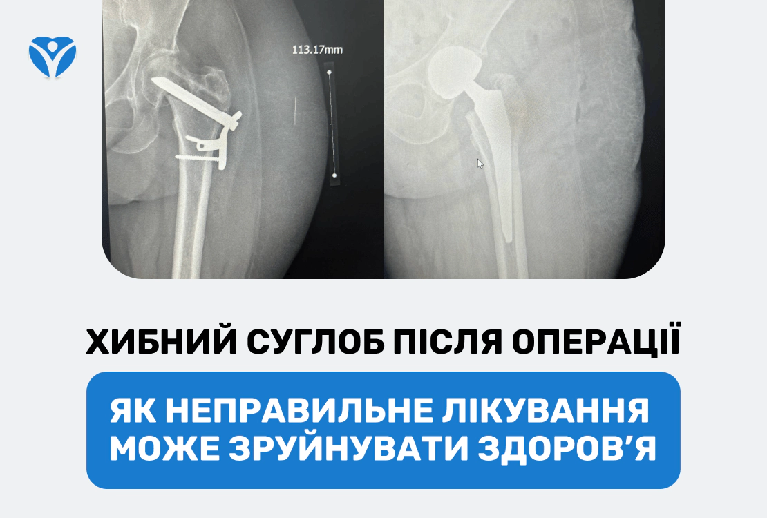 НЕВЕРНЫЙ СУСТАВ ПОСЛЕ ОПЕРАЦИИ: как неправильное лечение может разрушить здоровье