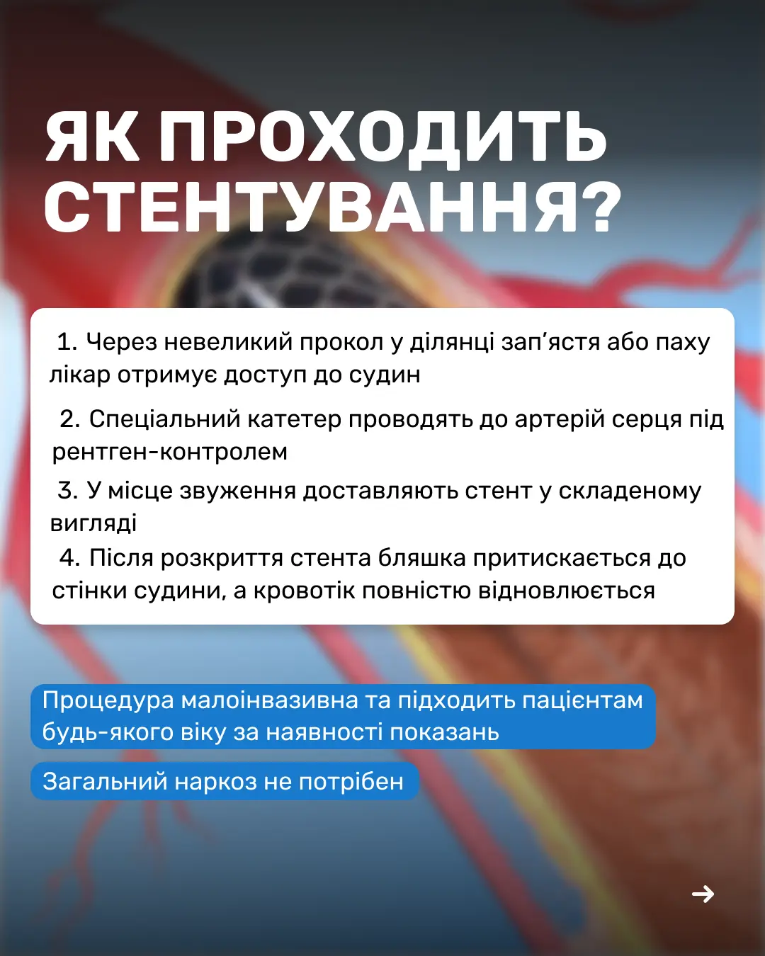 5 3 inst стенування (convert.io)