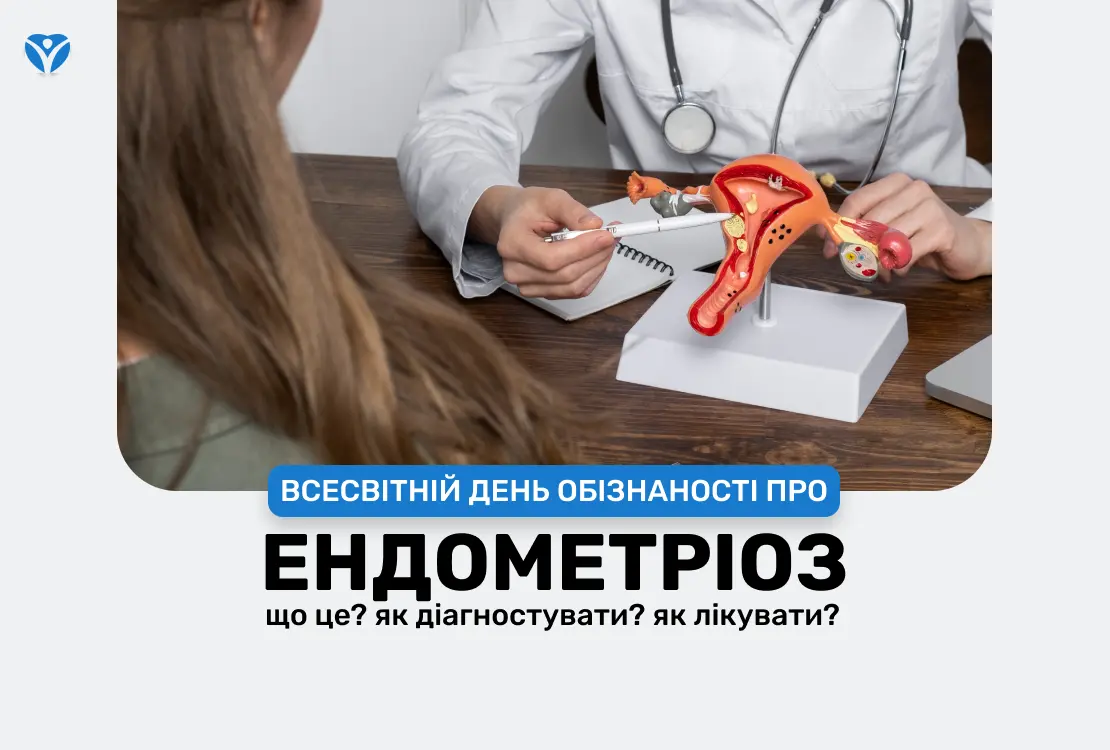 Вся правда про ендометріоз, яка може змінити ваше життя!
