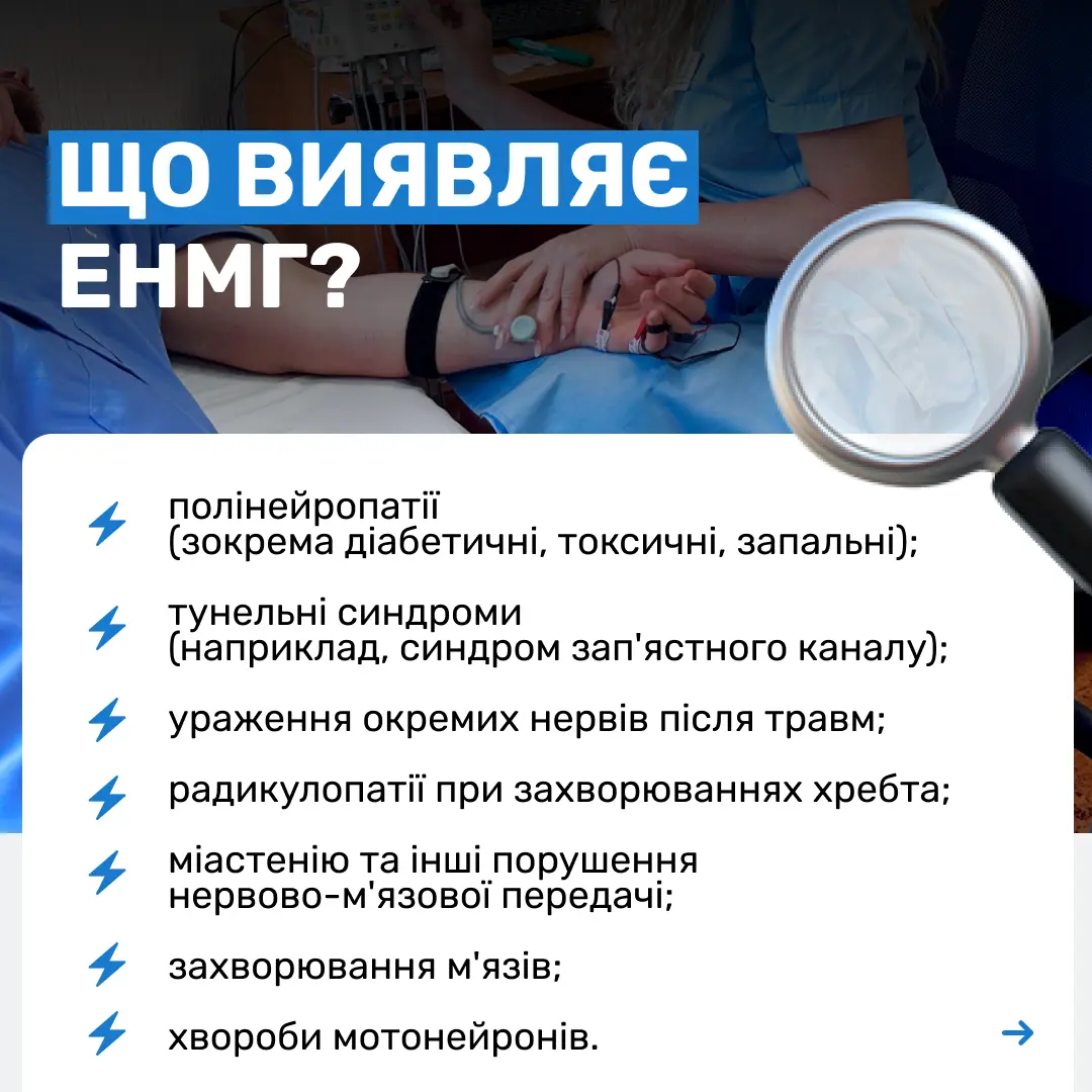 ЕНМГ 2